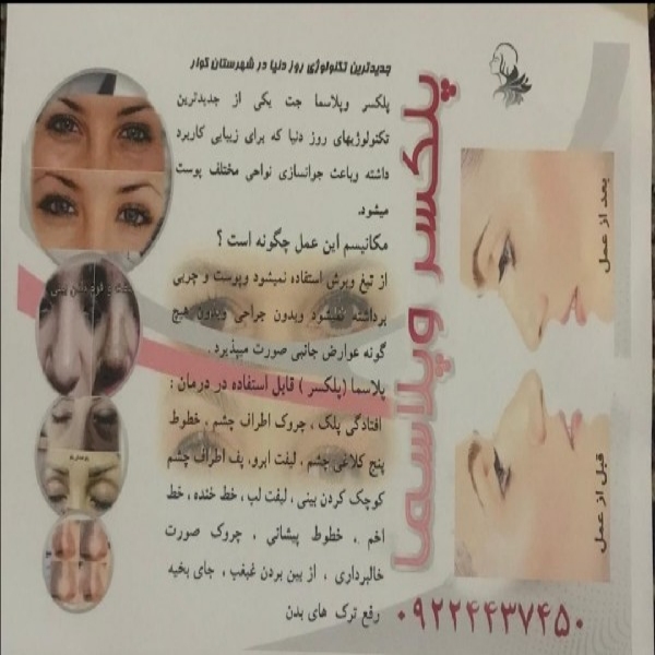 پلاسما جت